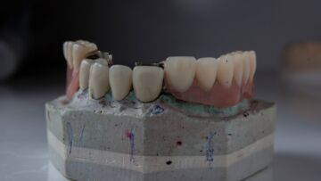 Kiedy ostatni raz byłeś u dentysty? Sanodental przypomina, jak często planować wizyty kontrolne!
